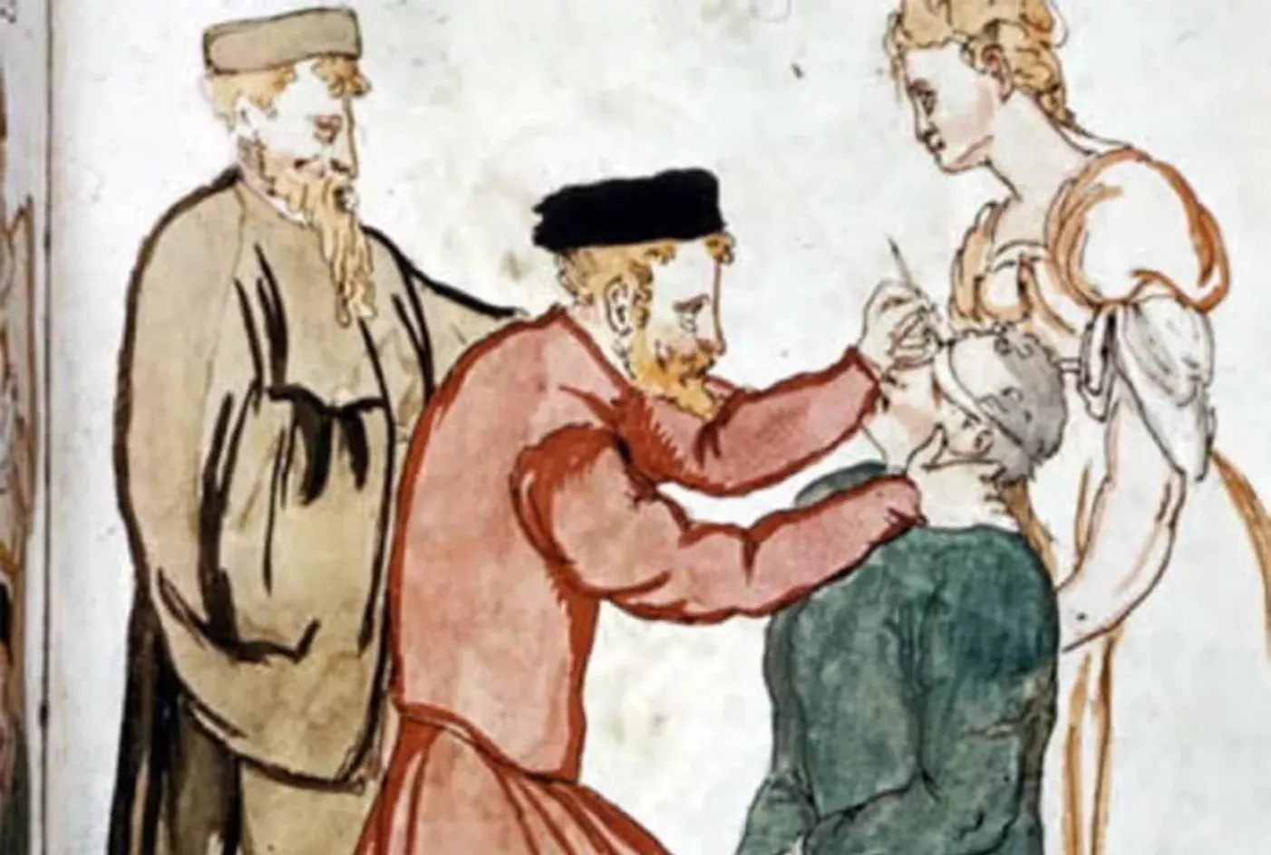Una intervenció de cataractes al segle XV
